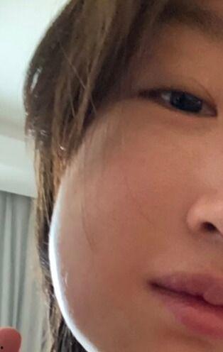 明星智齿,揭秘明星们的口腔秘密与美丽蜕变