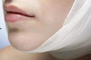 掉下巴图片,掉下巴的惊人瞬间揭秘